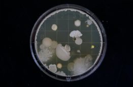 KTU mokslininkė: ginklas kovoje su ligų sukėlėjais – antibakteriniai paviršiai
