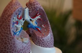 Operatyviai ir saugiai kovai su COVID-19 ir kitomis plaučių ligomis – KTU MGMF alumnų ir studentų kuriama unikali tyrimų sistema